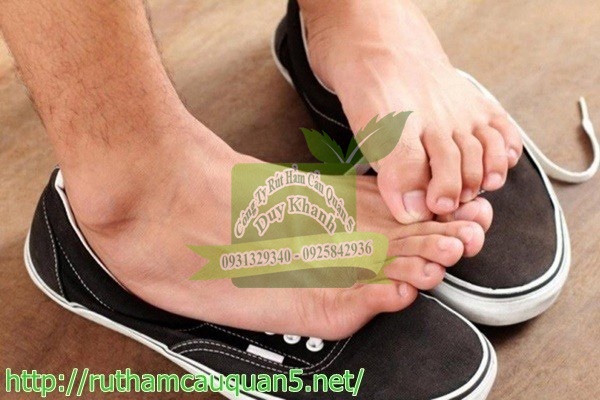 M&ugrave;i h&ocirc;i gi&agrave;y đến từ m&ugrave;i ở ch&acirc;n